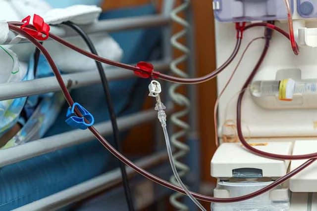 Dialysis tubing next to bed